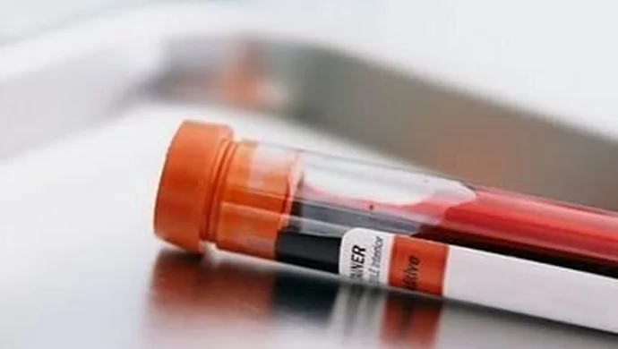 Oddaj próbkę krwi w Staszicu - możesz być dawcą szpiku kostnego