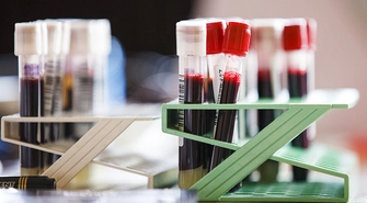 Oddali krew dla Wiktora