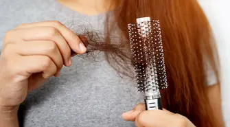  - 3 przyczyny łysienia