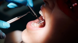 Dlaczego regularna profilaktyka stomatologiczna jest istotna?