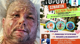 Przyjdź i pomóż Łukaszowi Topie. SP 1 organizuje „Topowy Czwartek”