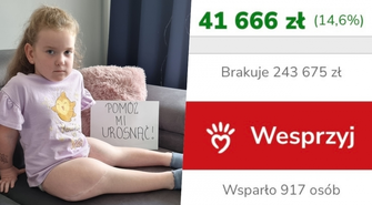Trwa wyścig z czasem o zdrowie małej Lilianki. Potrzeba ponad 240 tys. zł